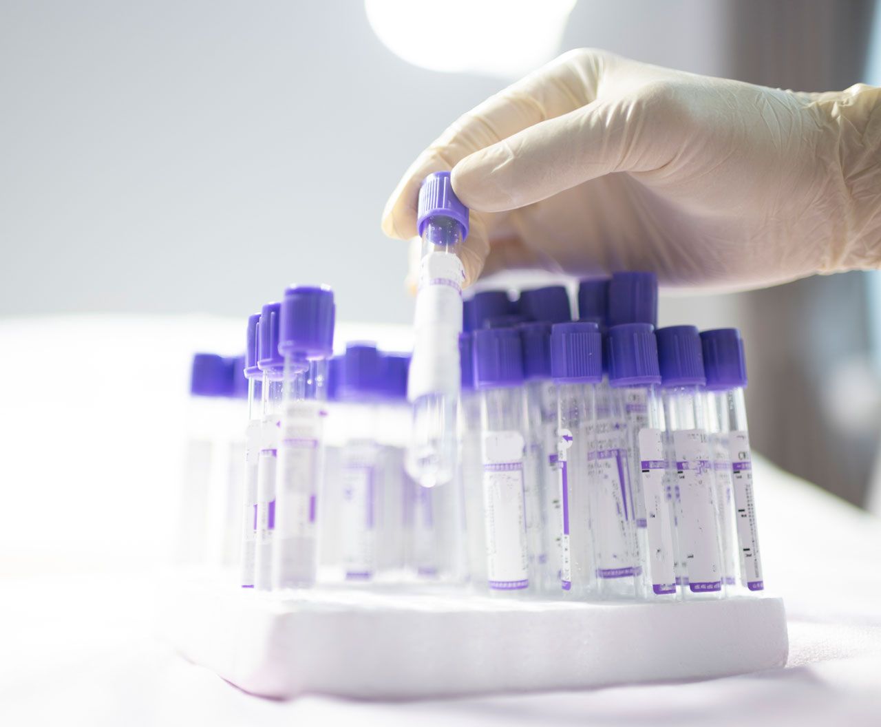 Laboratory Samples — San Diego, CA — Gaslamp Medical Center