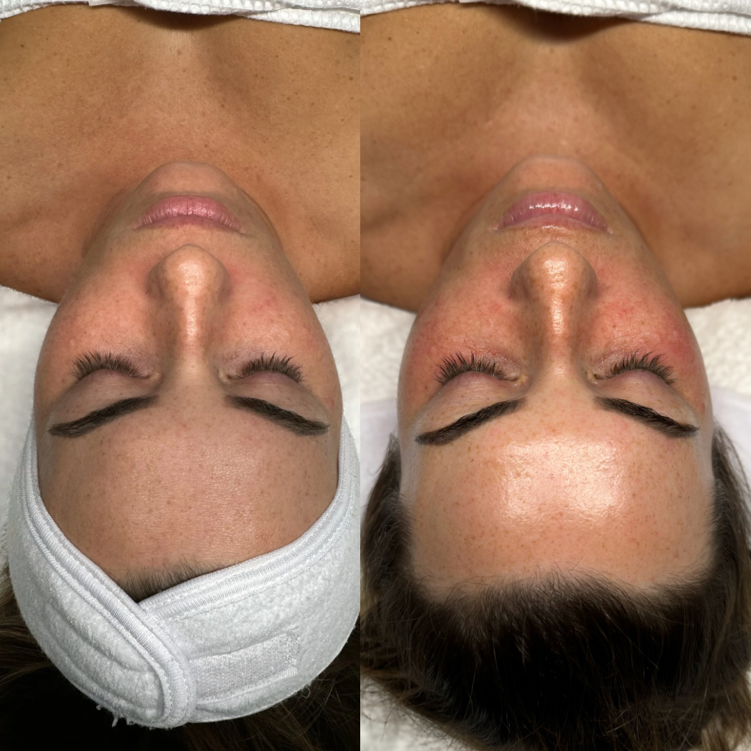 A woman is laying down with her eyes closed and a headband on her head.