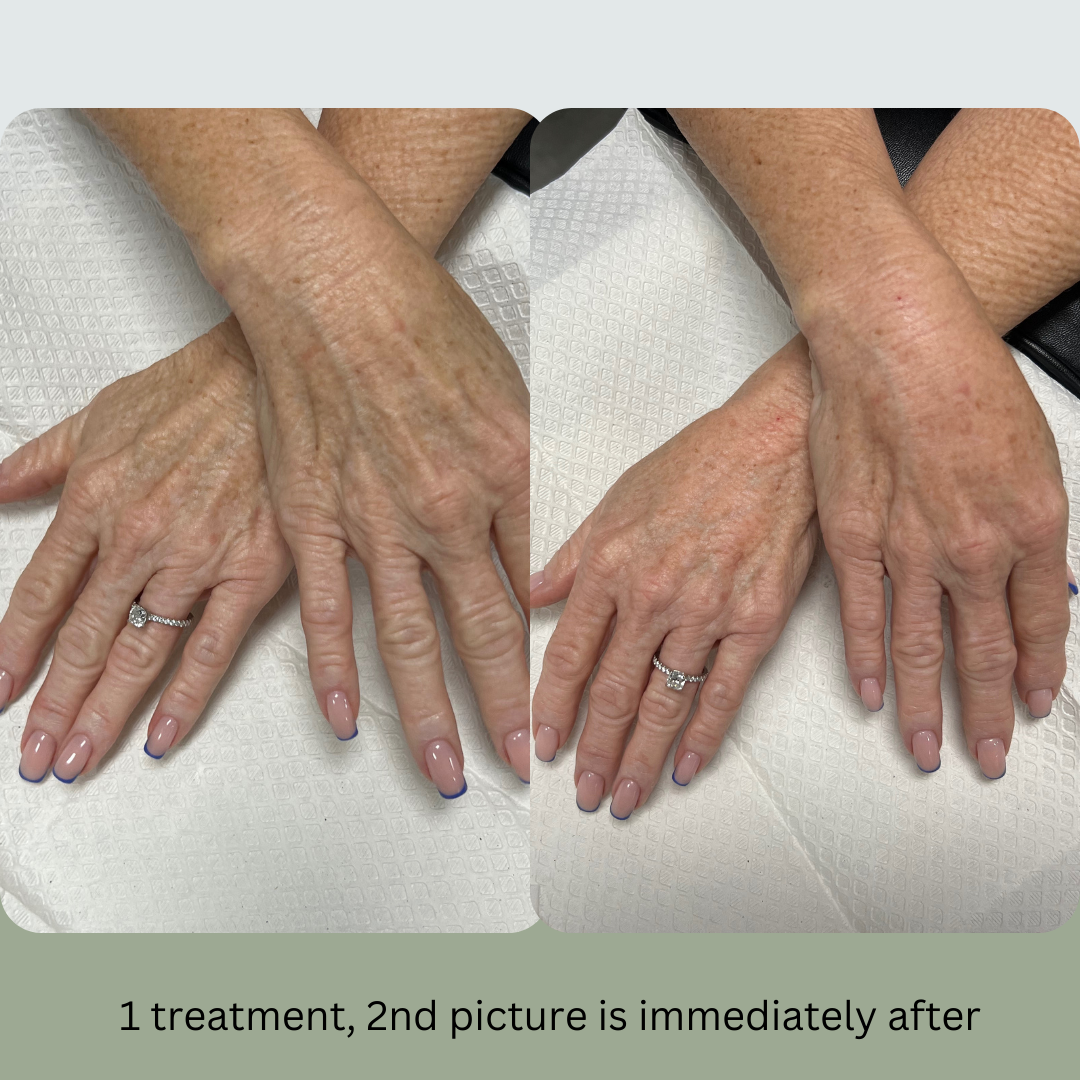 A before and after picture of a woman 's hands with rings on them