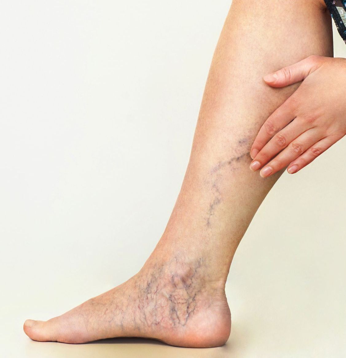 A woman is looking at her leg with a magnifying glass.