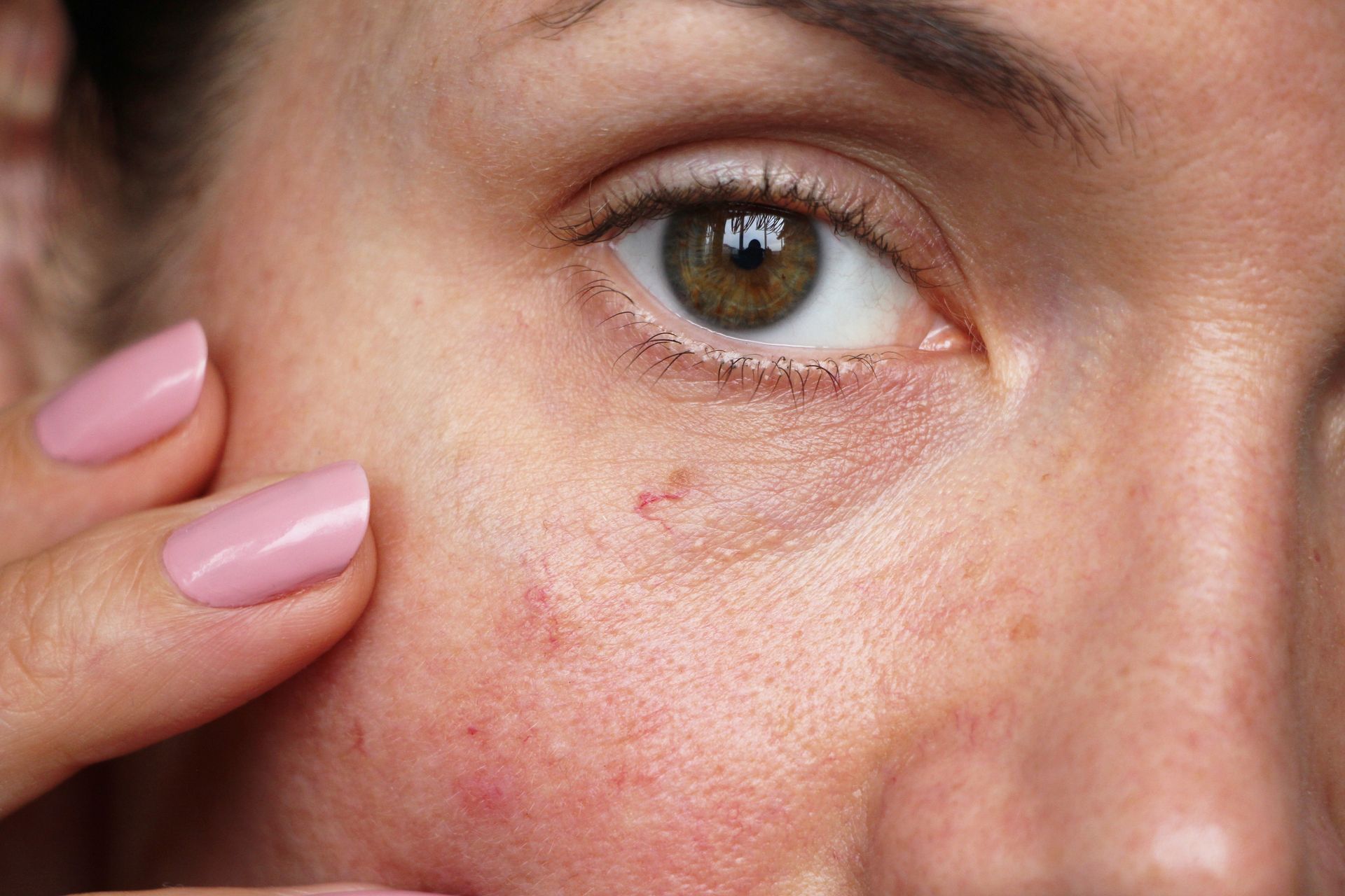 A close up of a woman 's face with pink nails.