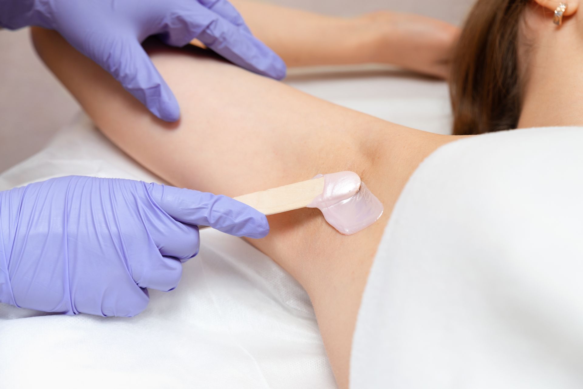 Person receiving armpit wax treatment; gloved hands applying wax with a spatula.