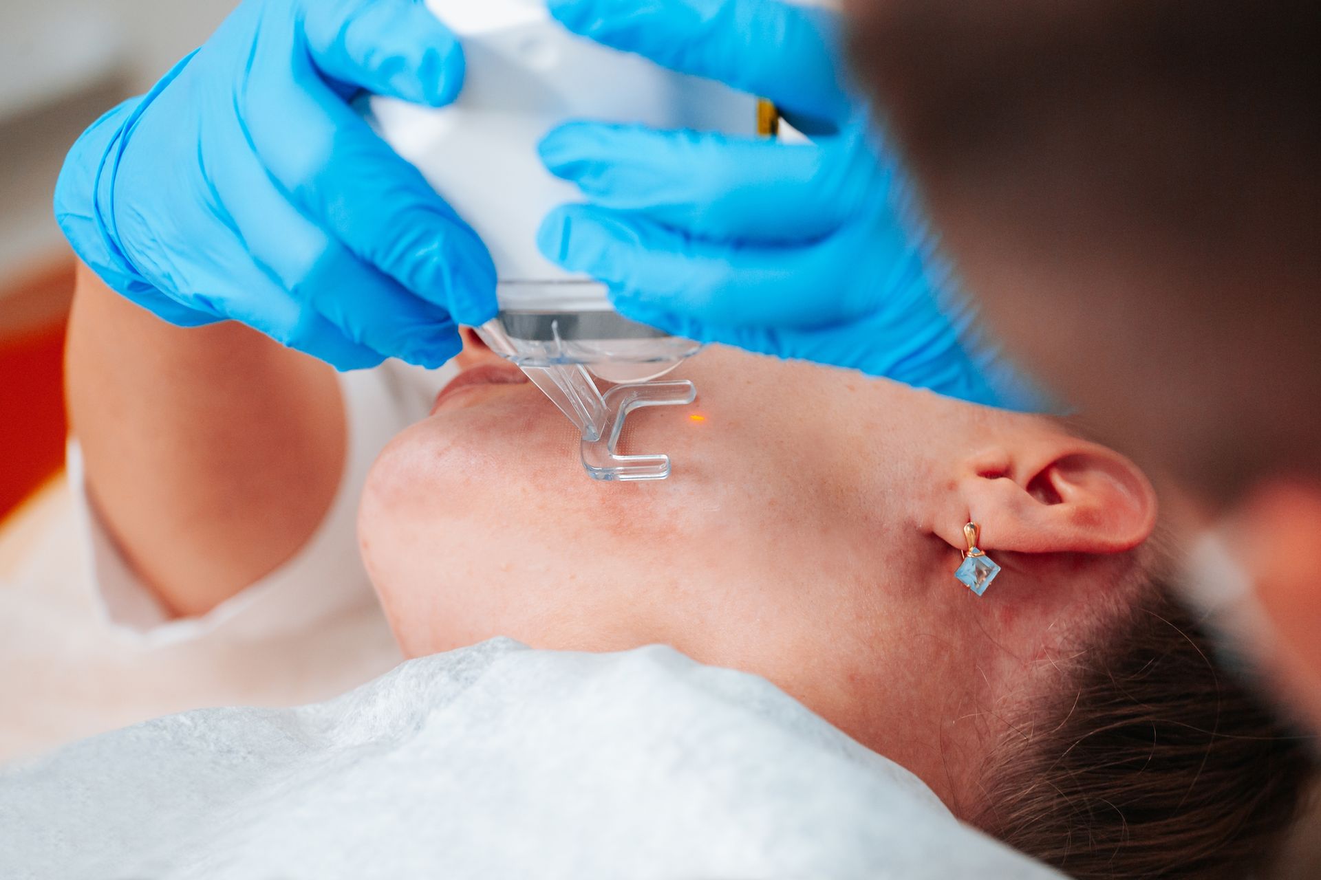A woman is getting a laser treatment on her face.