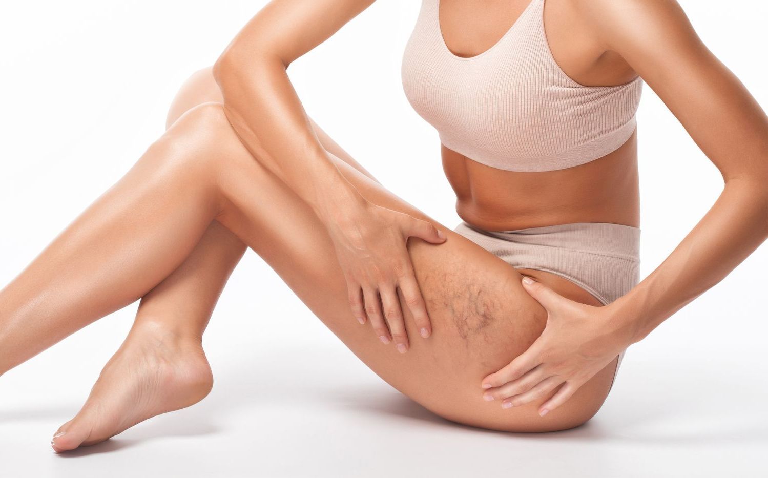 Spider Veins Correction