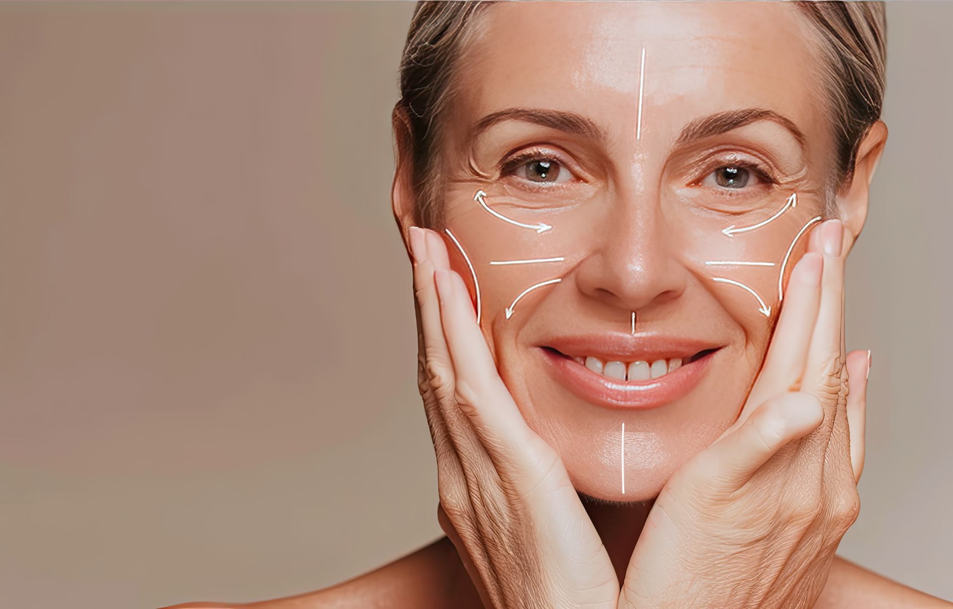 Woman smiling, hands on cheeks. White lines show facial skin tightening.