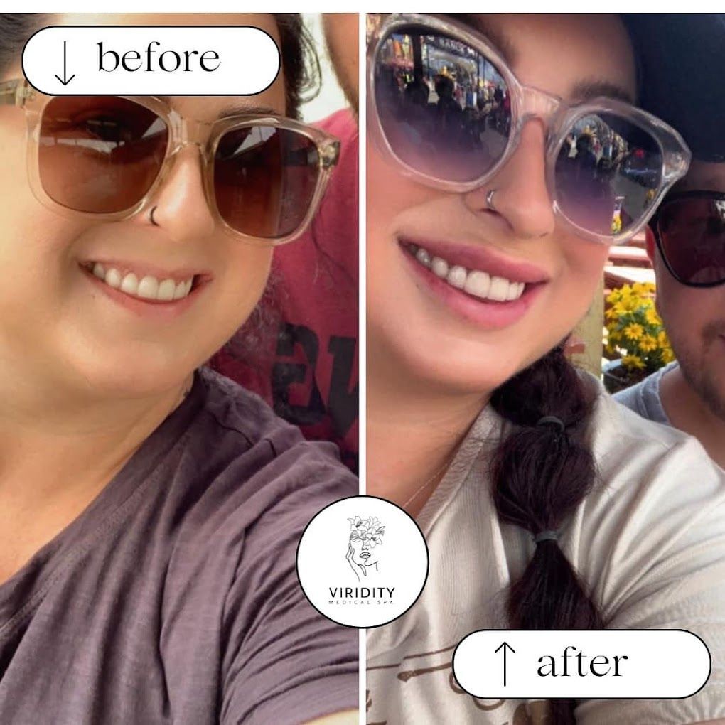A before and after picture of a woman wearing sunglasses.