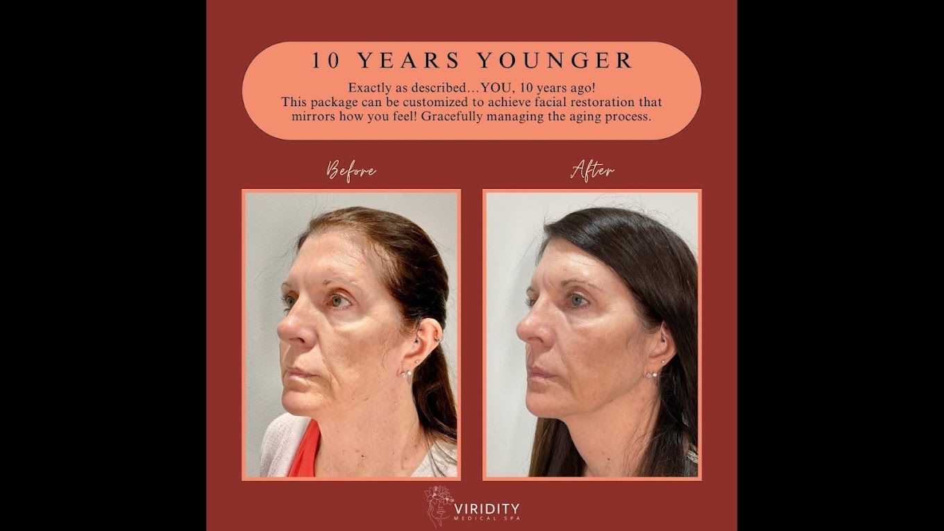 A before and after photo of a woman 's face.