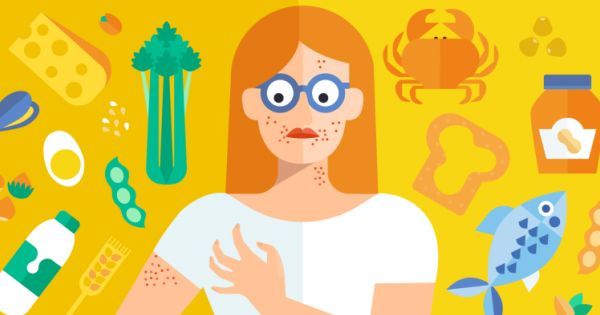 An illustration of a woman with a rash on her arm surrounded by food allergens.