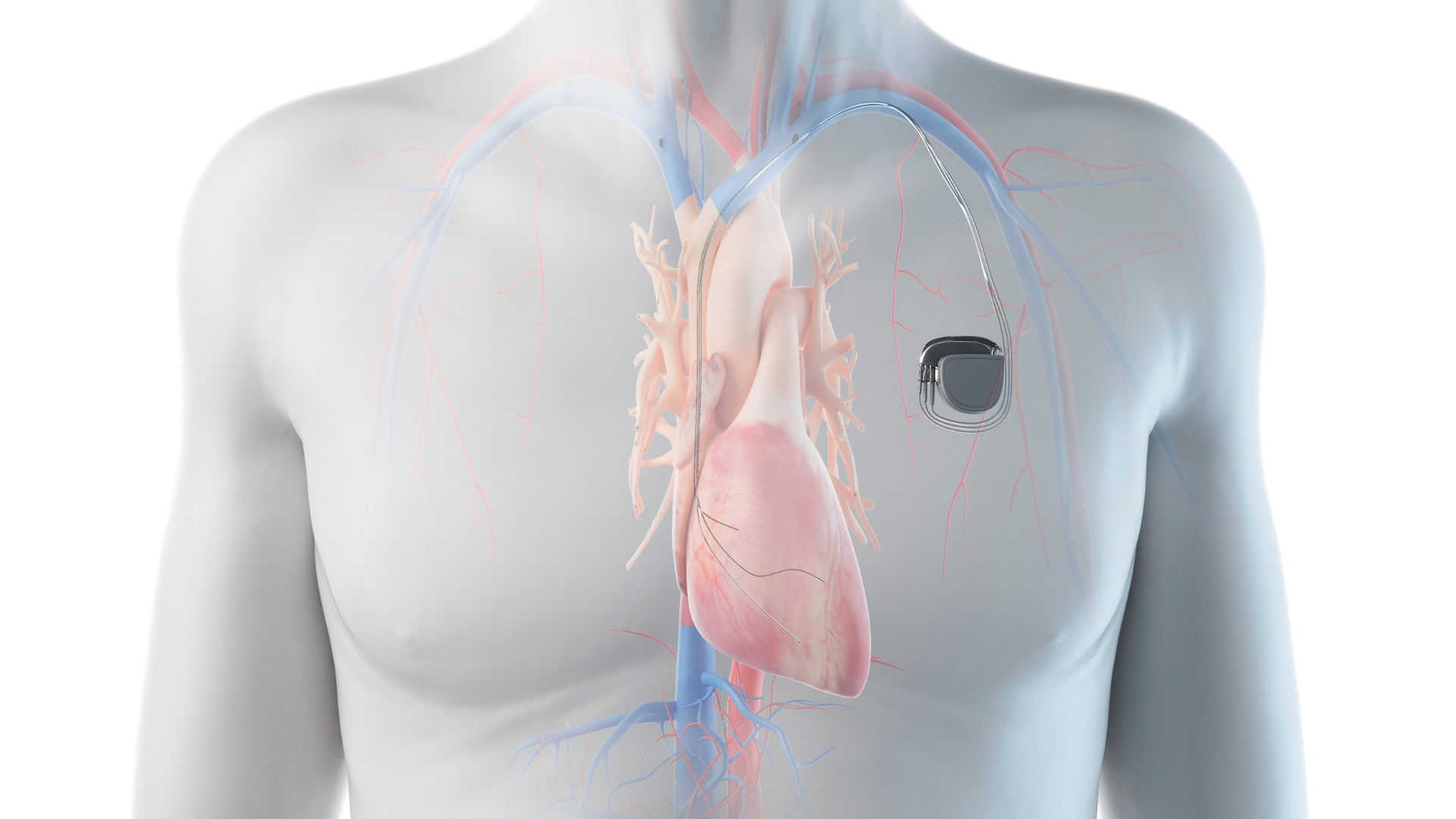 A close up of a man 's chest with a heart monitor attached to it.