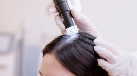A medical professional examines a person's scalp with a handheld device under bright light.