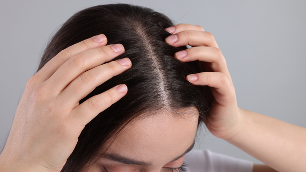 Woman's hands touching her dark hair parting, revealing her scalp.