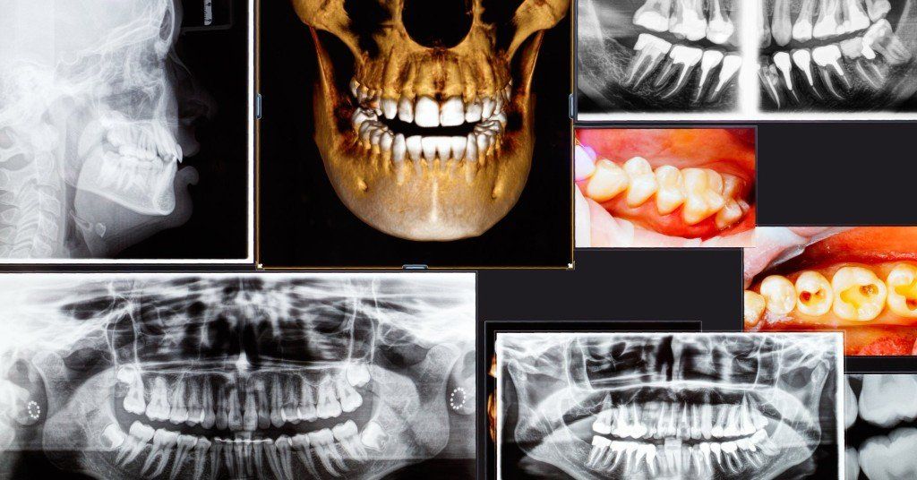 Picture of 3D Dental Imaging