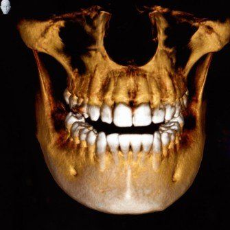 3D Dental X-Ray Imaging