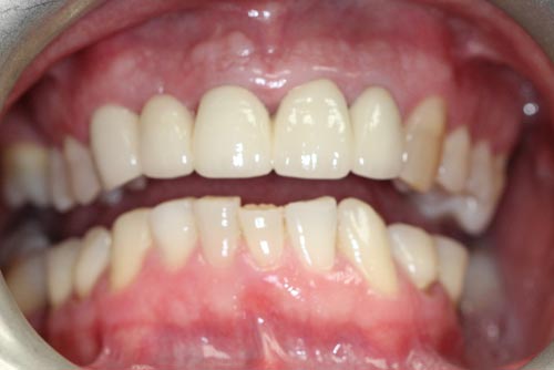 A close up of a person 's mouth with white teeth.