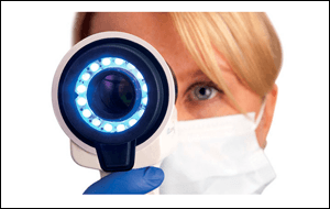 VELscope oral cancer screening device