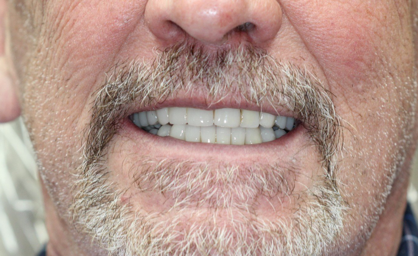 A man with a beard and white teeth is smiling.