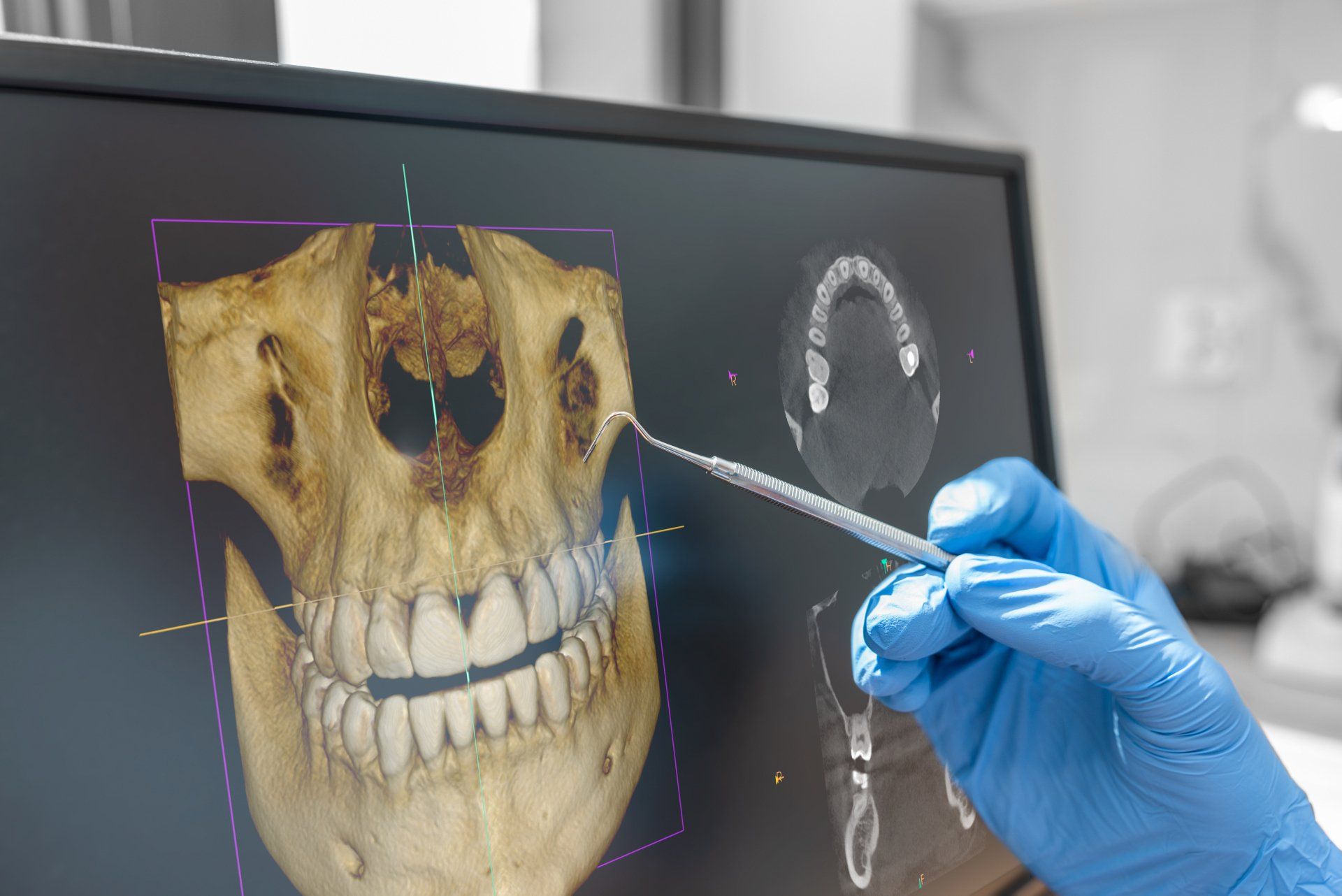 Picture of 3D Dental Imaging