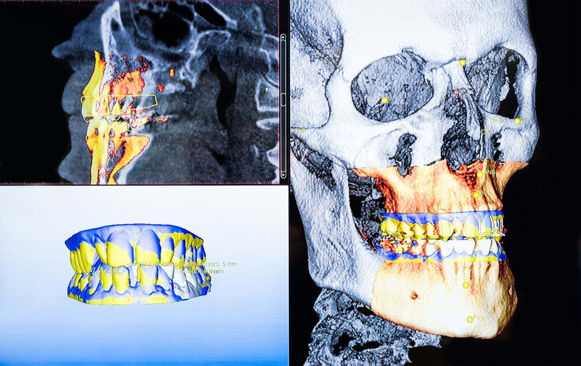 3D Dental X-Ray Imaging