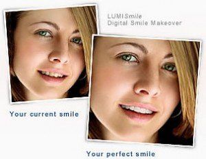 LUMISmile Digital Smile Makeover Photo of Girl Before and After