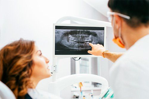 Digital X-rays - StarBrite Dental Services