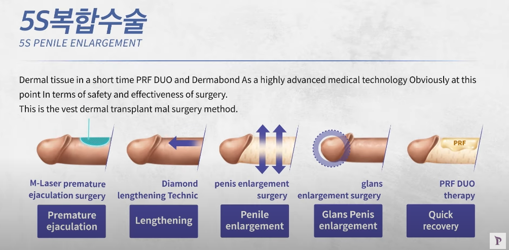 Penile Enlargement Surgery | Proud Urology Clinic