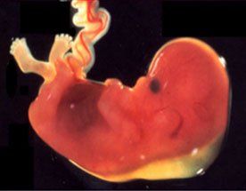 translucenza anormale