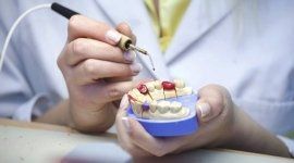 dentista, odontoiatri, allineamento denti bambino