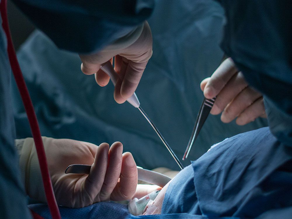 Hand Surgery — Sterling Heights, MI — Intracare Surgery Center