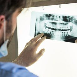 Doctor checking the xray — Dental Implants in Springfield, PA