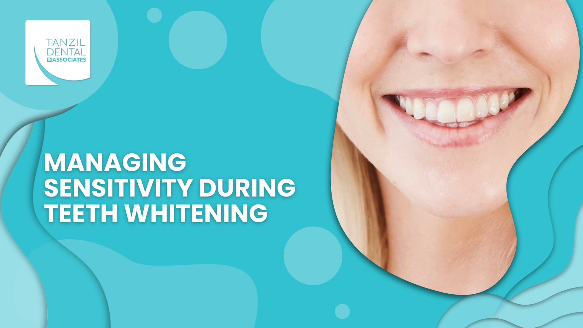 A close up of a woman 's smile with the words `` managing sensitivity during teeth whitening ''.