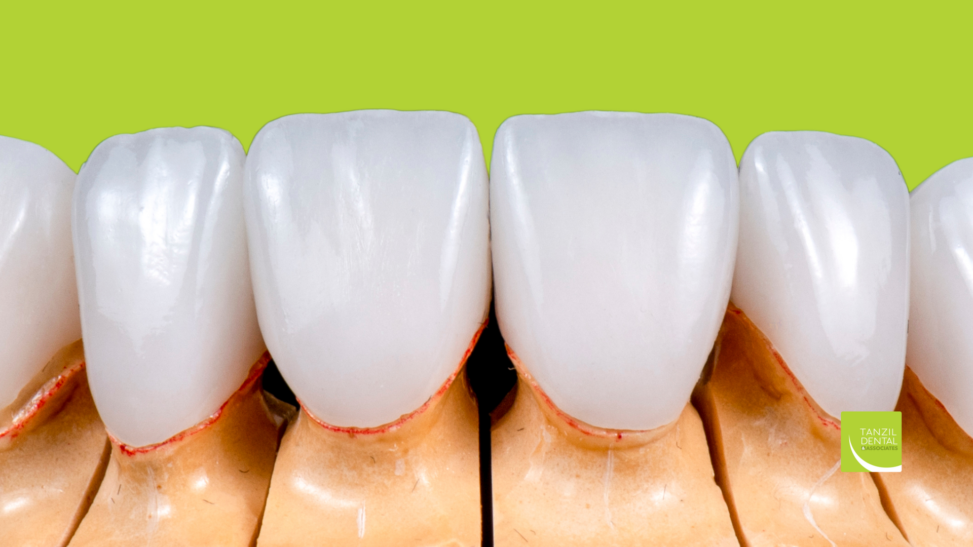 A close up of a row of white teeth on a green background.