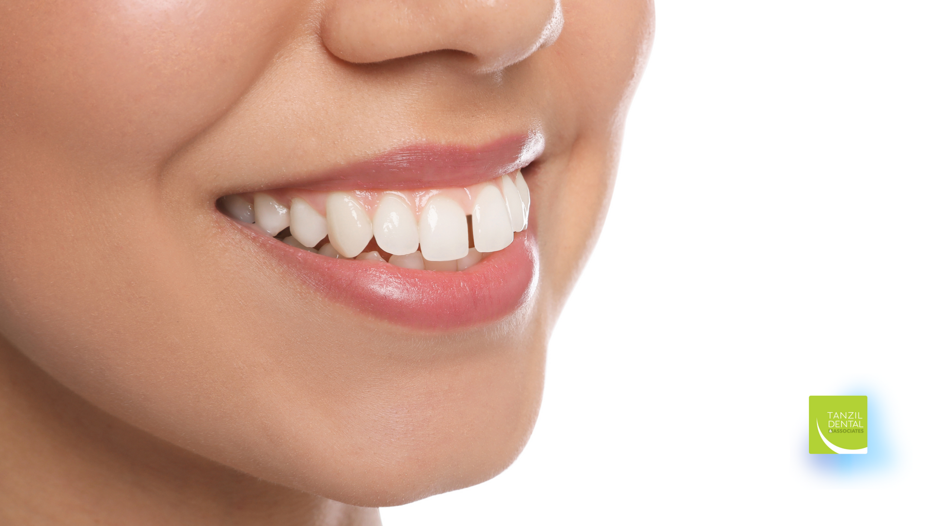 A close up of a woman 's smile with white teeth.