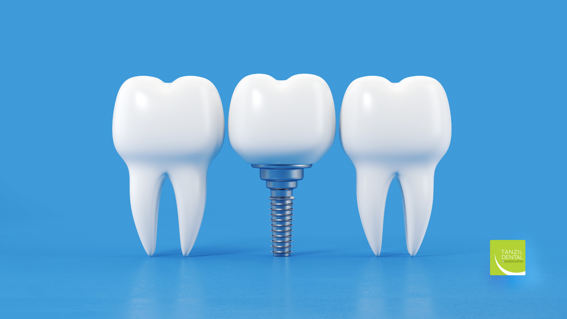 Three teeth, one is a dental implant, on a blue background.