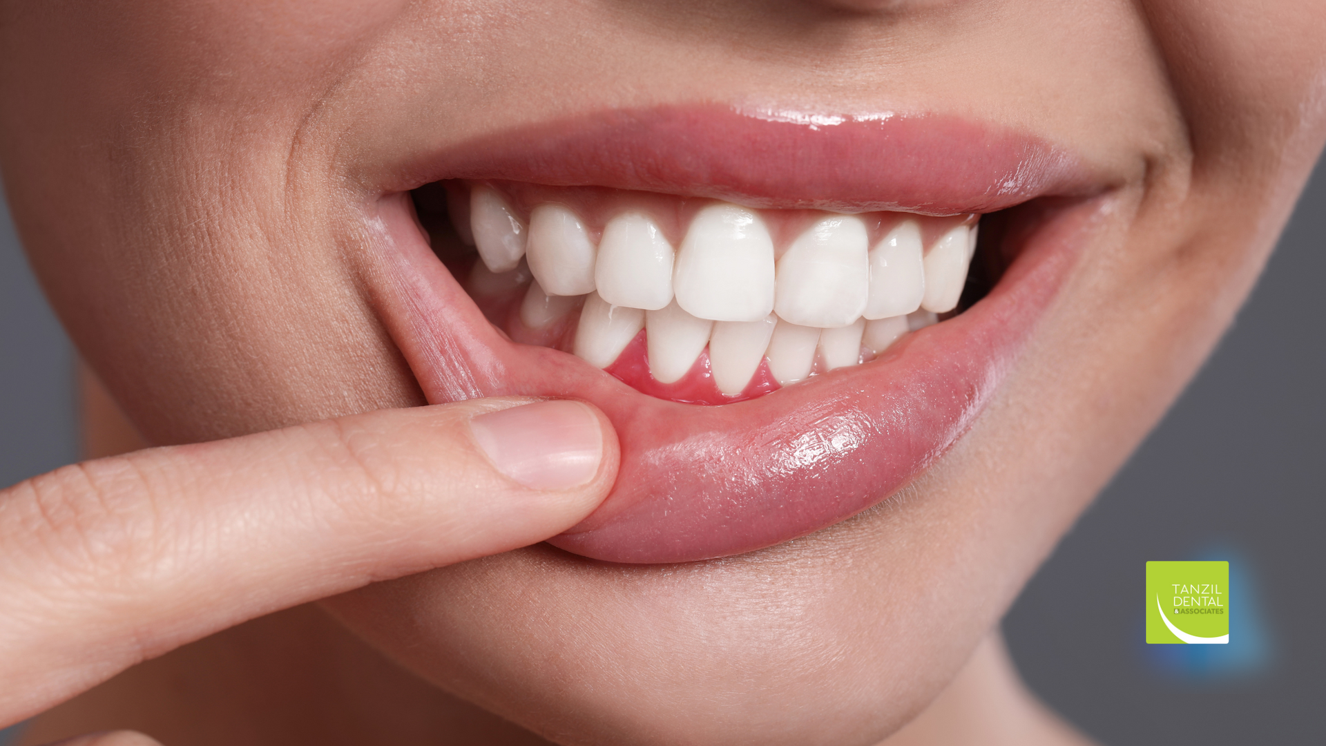 A close up of a woman 's mouth with a toothache.