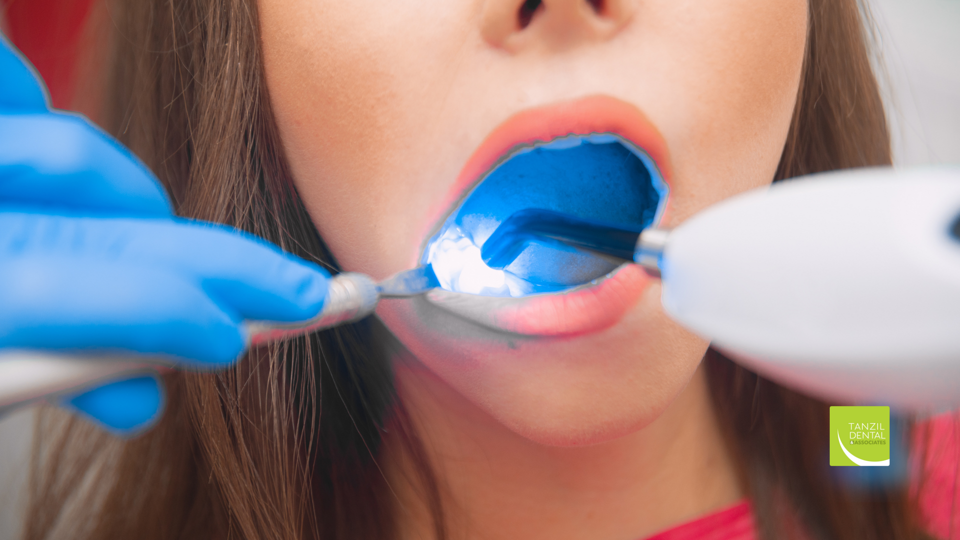 A woman is getting her teeth examined by a dentist.