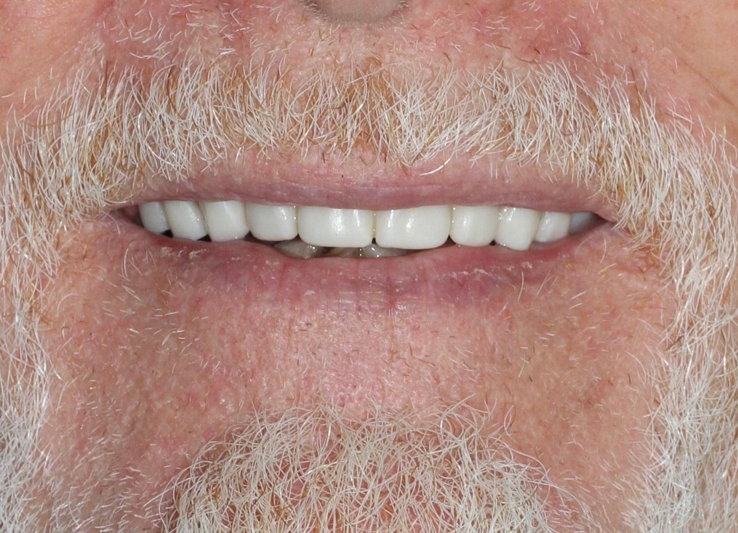 A man with a beard and white teeth is smiling.