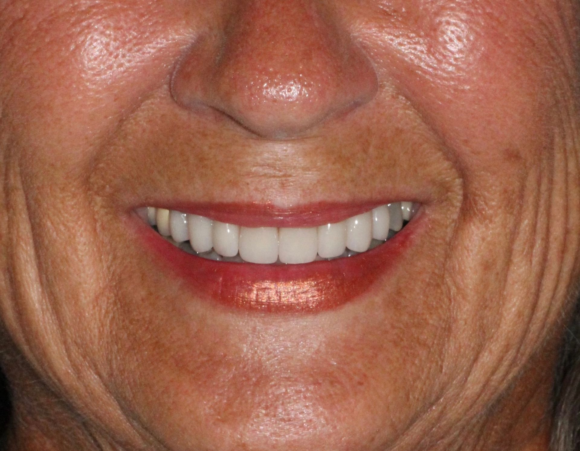 A close up of a woman 's smile with white teeth and red lips.