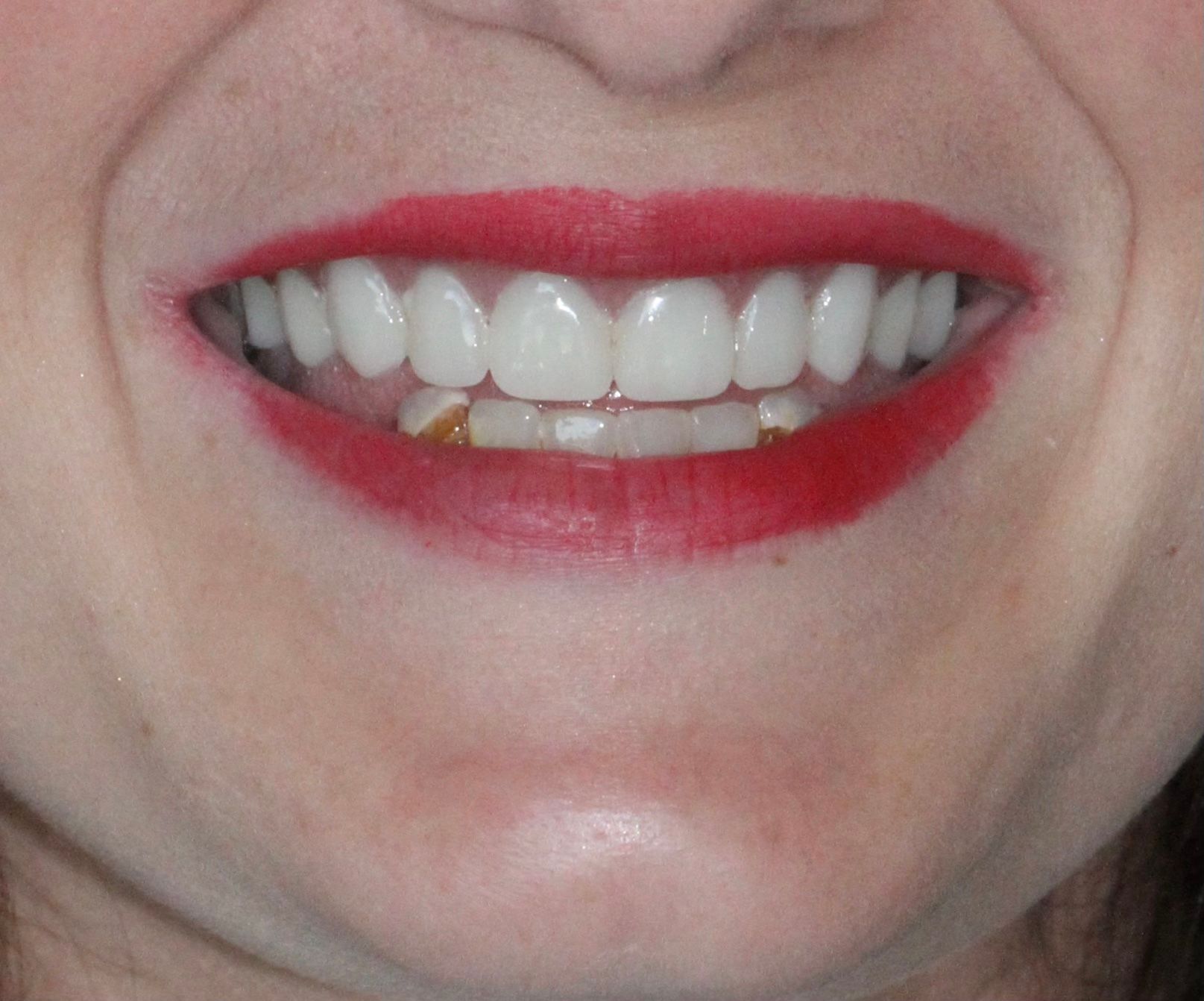 A close up of a woman 's mouth with white teeth and red lipstick