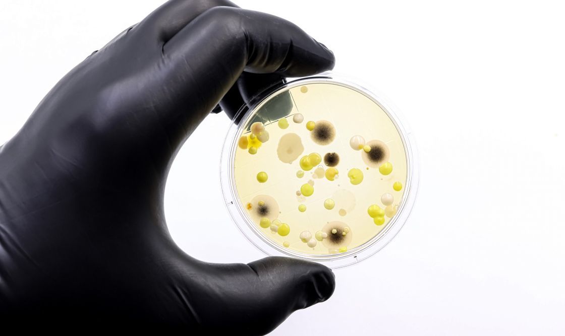 mould bacteria in a petri dish