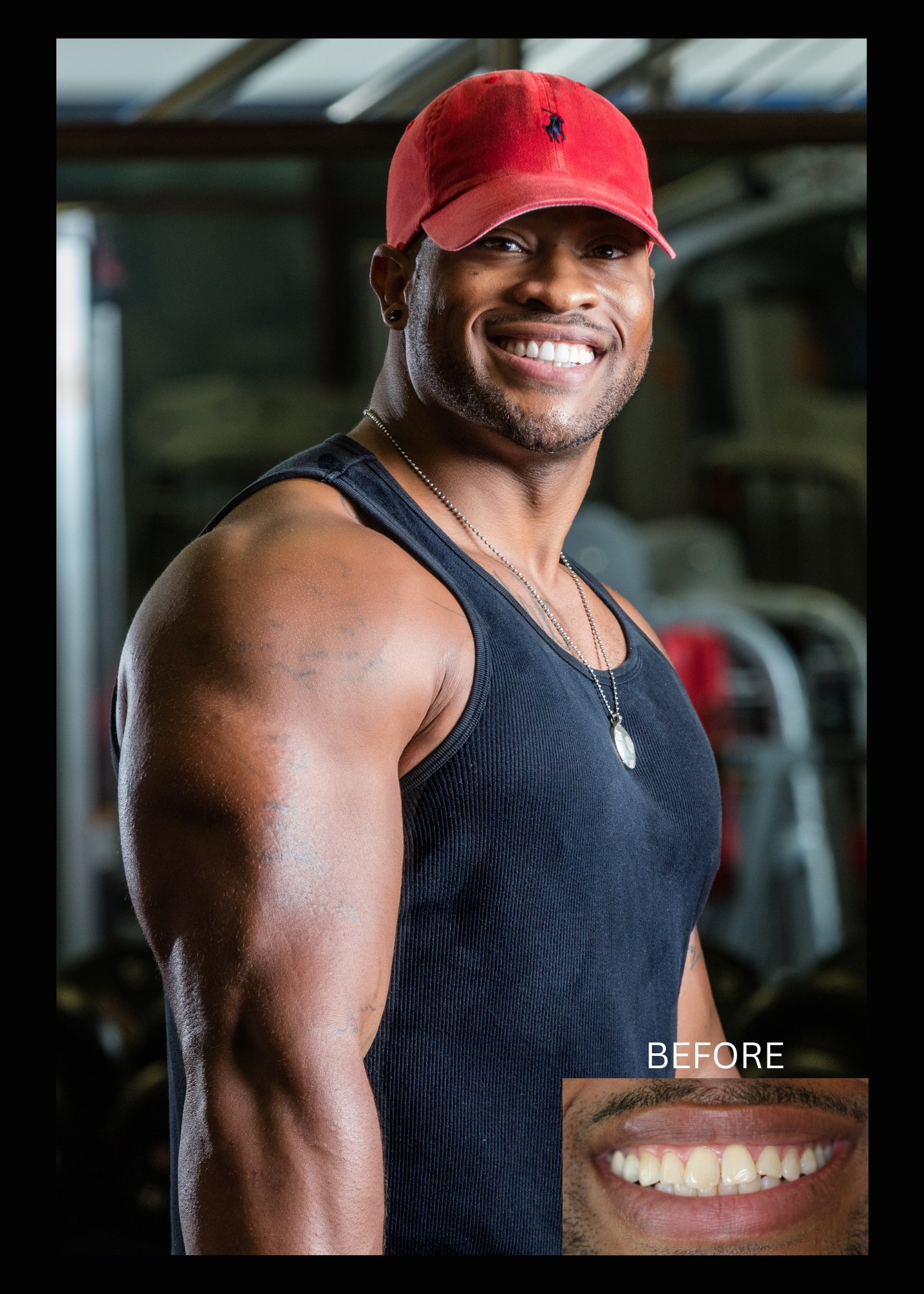 SmileArt patient in a red cap smiles, posing in a gym. 