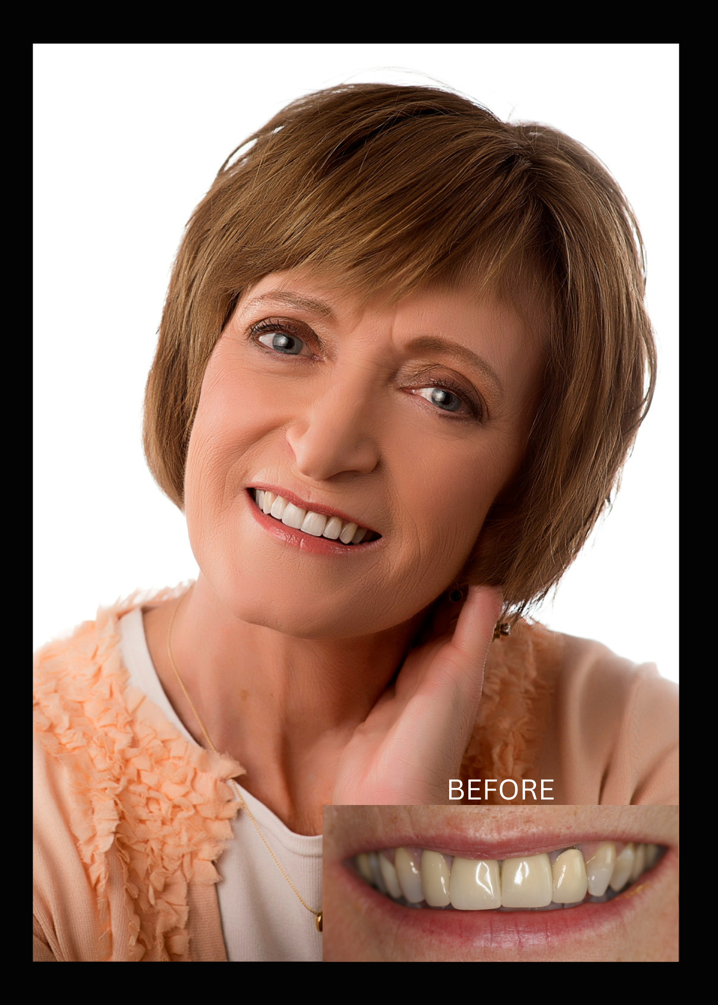 SmileArt patient smiling, hand near face, with 