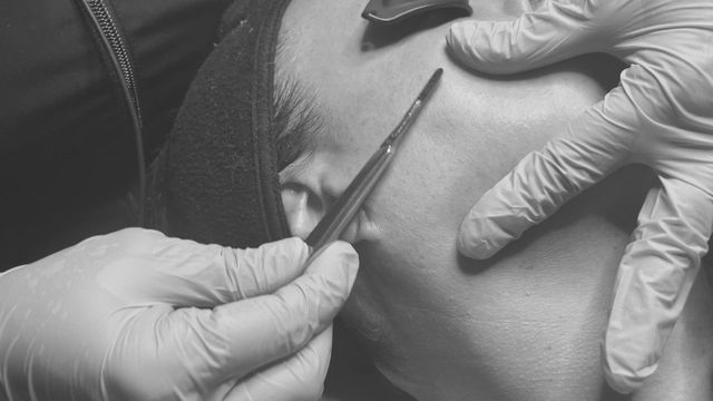 Uveitis May Be Linked with Tattoos More Than Previously Thought  American  Academy of Ophthalmology