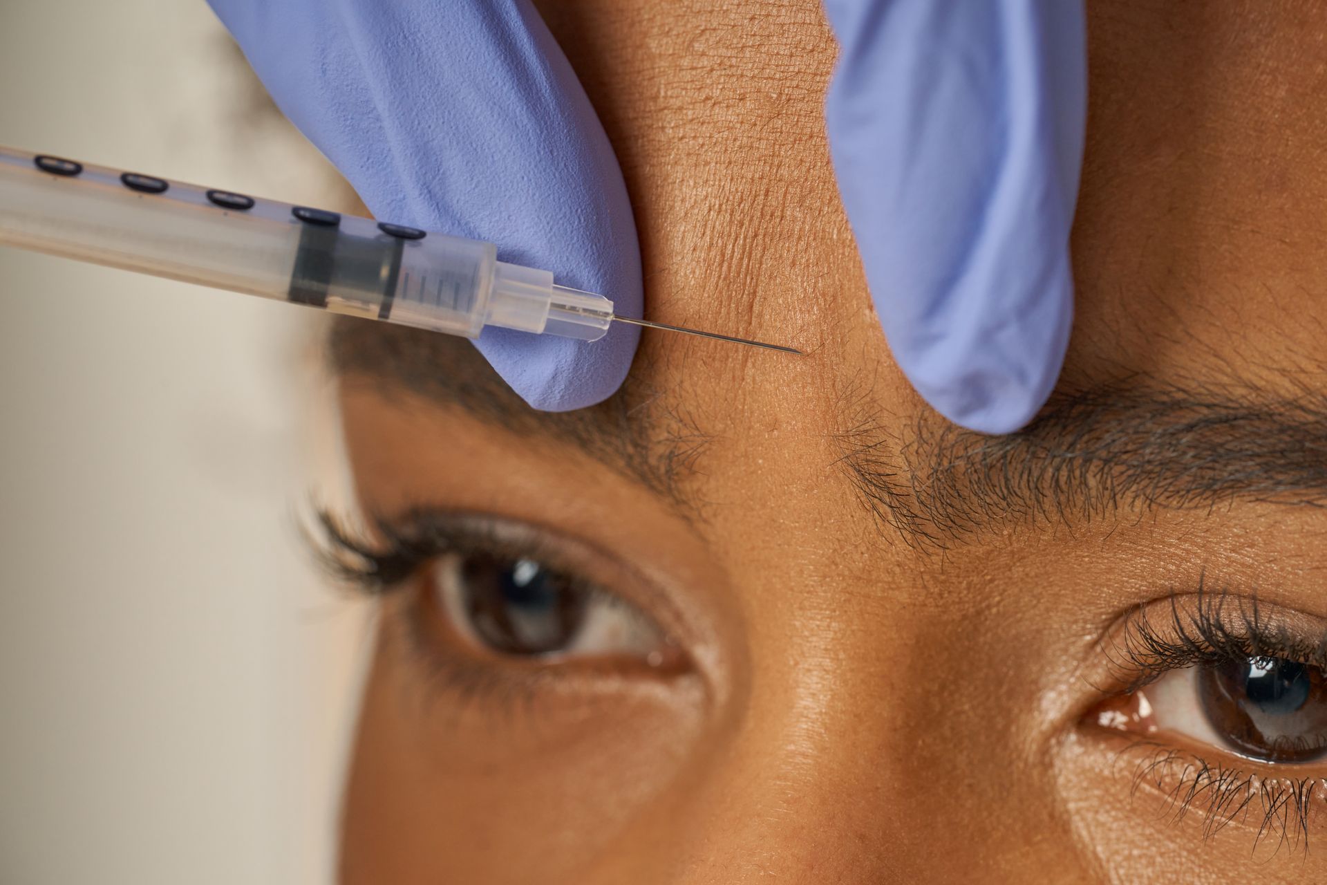 Rosacea treatments in Matawan, NJ
