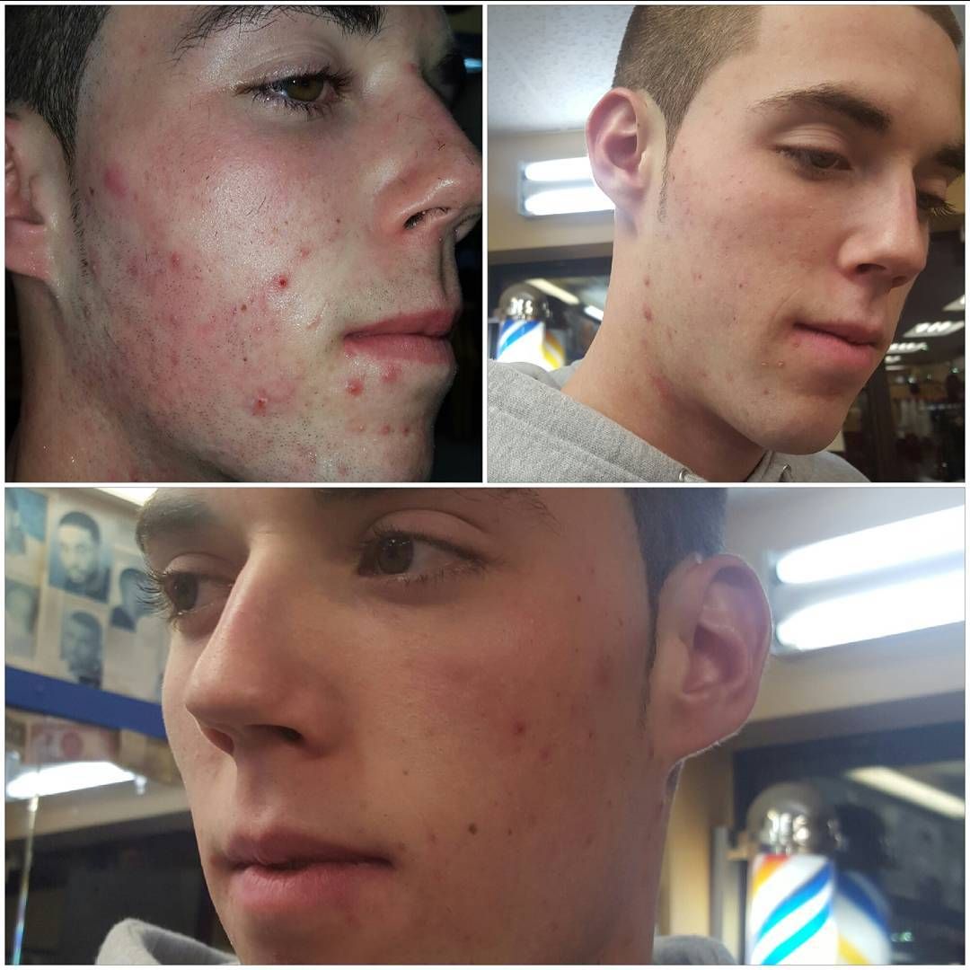 A collage of four pictures of a young man 's face