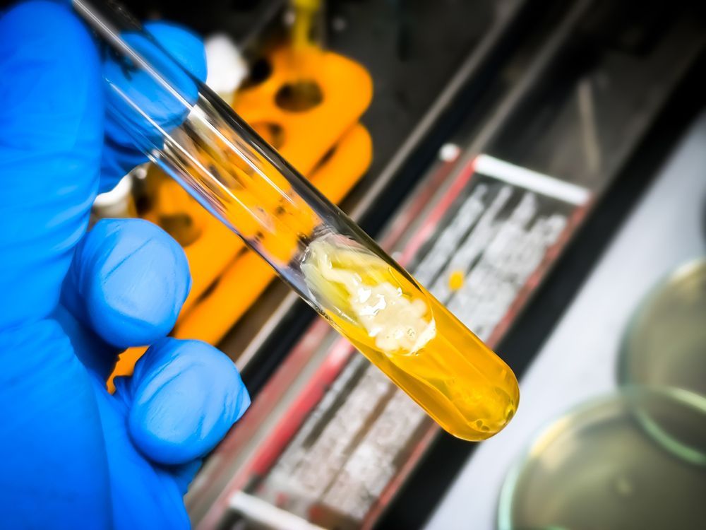 A person is holding a test tube with a yellow liquid in it.