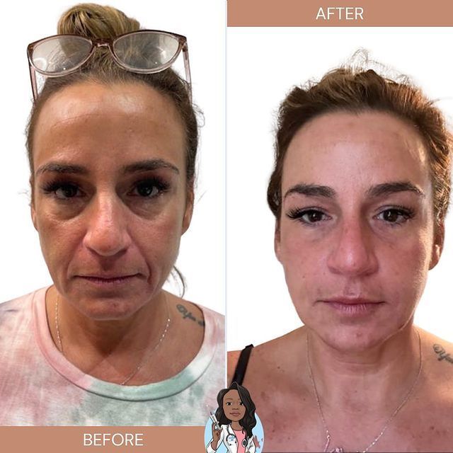 A before and after photo of a woman's face