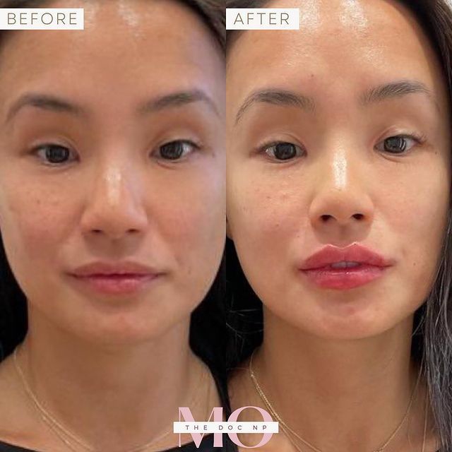A before and after photo of a woman's face