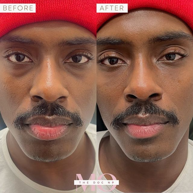 A before and after photo of a man with a mustache wearing a red hat.