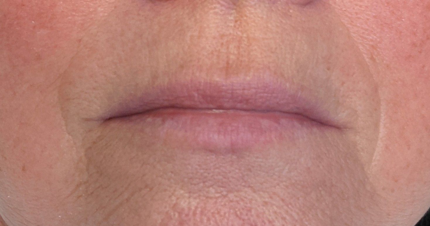 A close up of a woman 's lips with wrinkles.