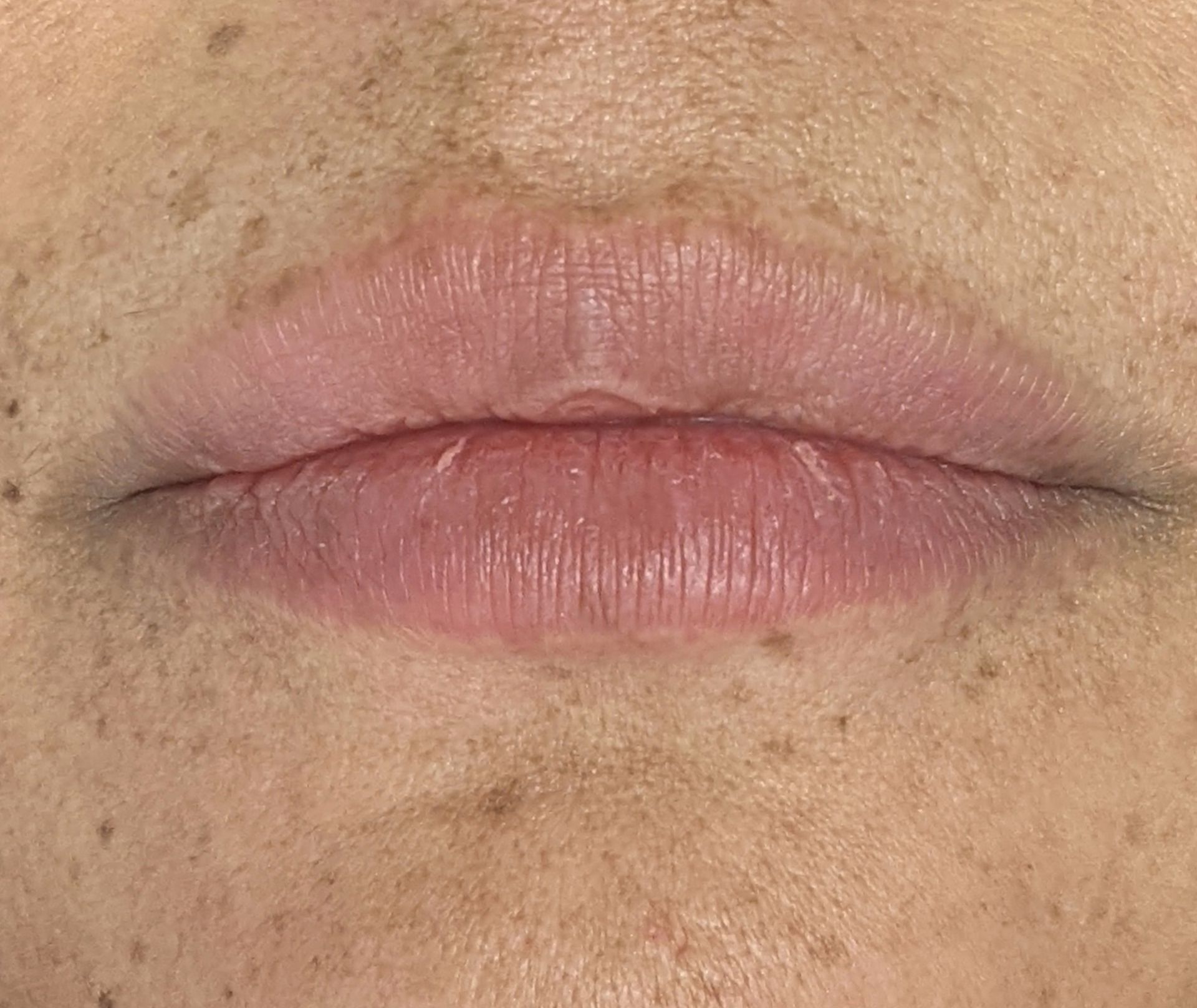 A close up of a woman 's lips with freckles.